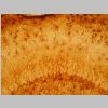 Astroglia GFAP 13.jpg